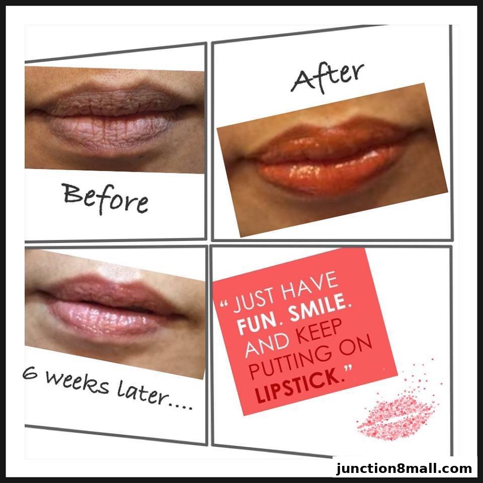 A collage showing before and after lip treatments, with a motivational quote.